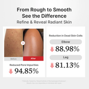 medicube Hypochlorous Acid Body Peel Shot [280ml]