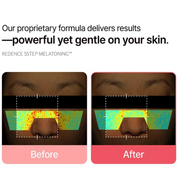FULLight Re:dence Tone & Spot Corrector Ampoule [30ml]