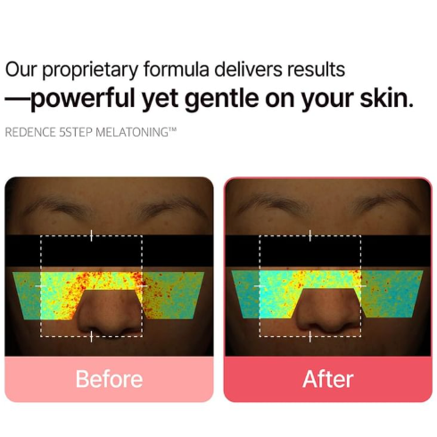 FULLight Re:dence Tone & Spot Corrector Ampoule [30ml]