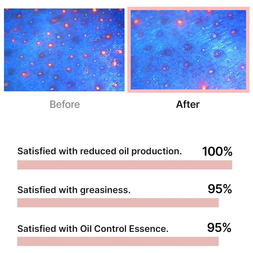 celimax Oil Control Capsule Essence [30ml]