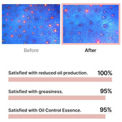 celimax Oil Control Capsule Essence [30ml]