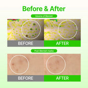 ACROPASS Dark Spot Care Microcone Patch