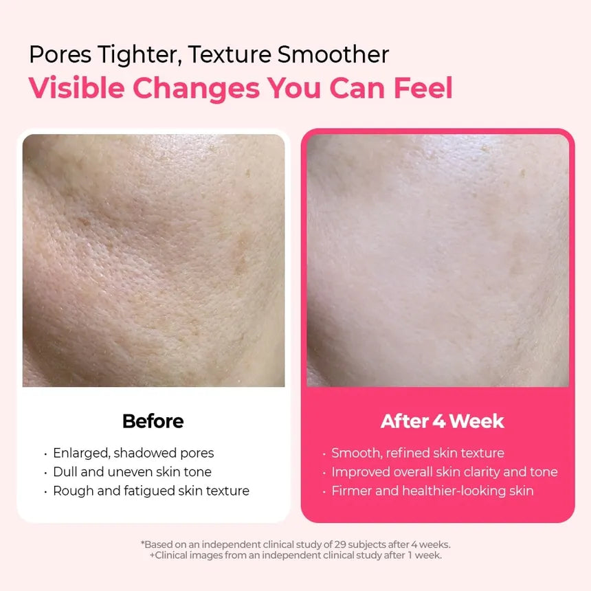 Dr.Melaxin Cemenrete Cyano Pink Spicule Serum [30ml]
