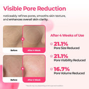 Dr.Melaxin Cemenrete Cyano Pink Spicule Serum [30ml]