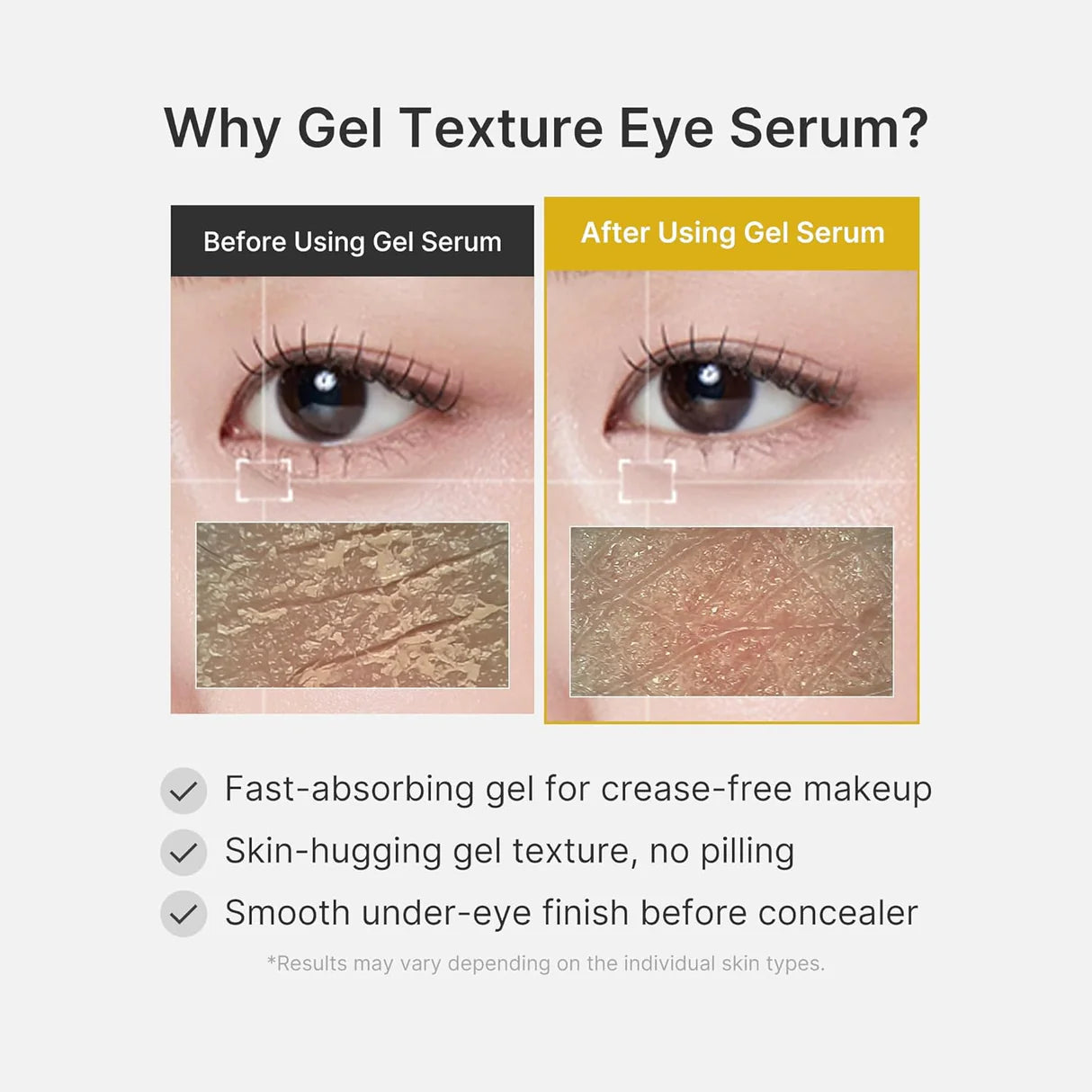 medicube Kojic Acid Turmeric Vita Eye Gel Serum [30ml]