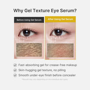 medicube Kojic Acid Turmeric Vita Eye Gel Serum [30ml]
