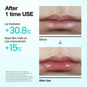 Anua PDRN Lip Serum [10ml]