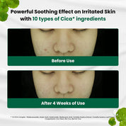 DR.G R.E.D BLEMISH CLEAR SOOTHING CREAM