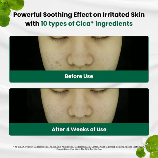 DR.G R.E.D BLEMISH CLEAR SOOTHING CREAM
