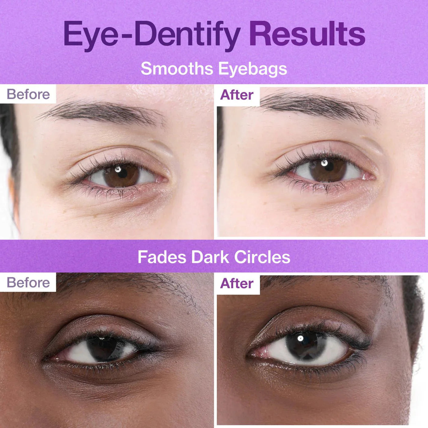numbuzin No.9 NAD+ Collagen Under Eye Patches [5ea]